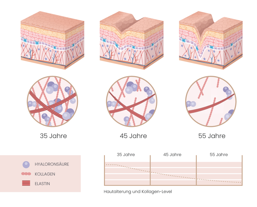 grafik hautalterung elastin kollagen dr bauer